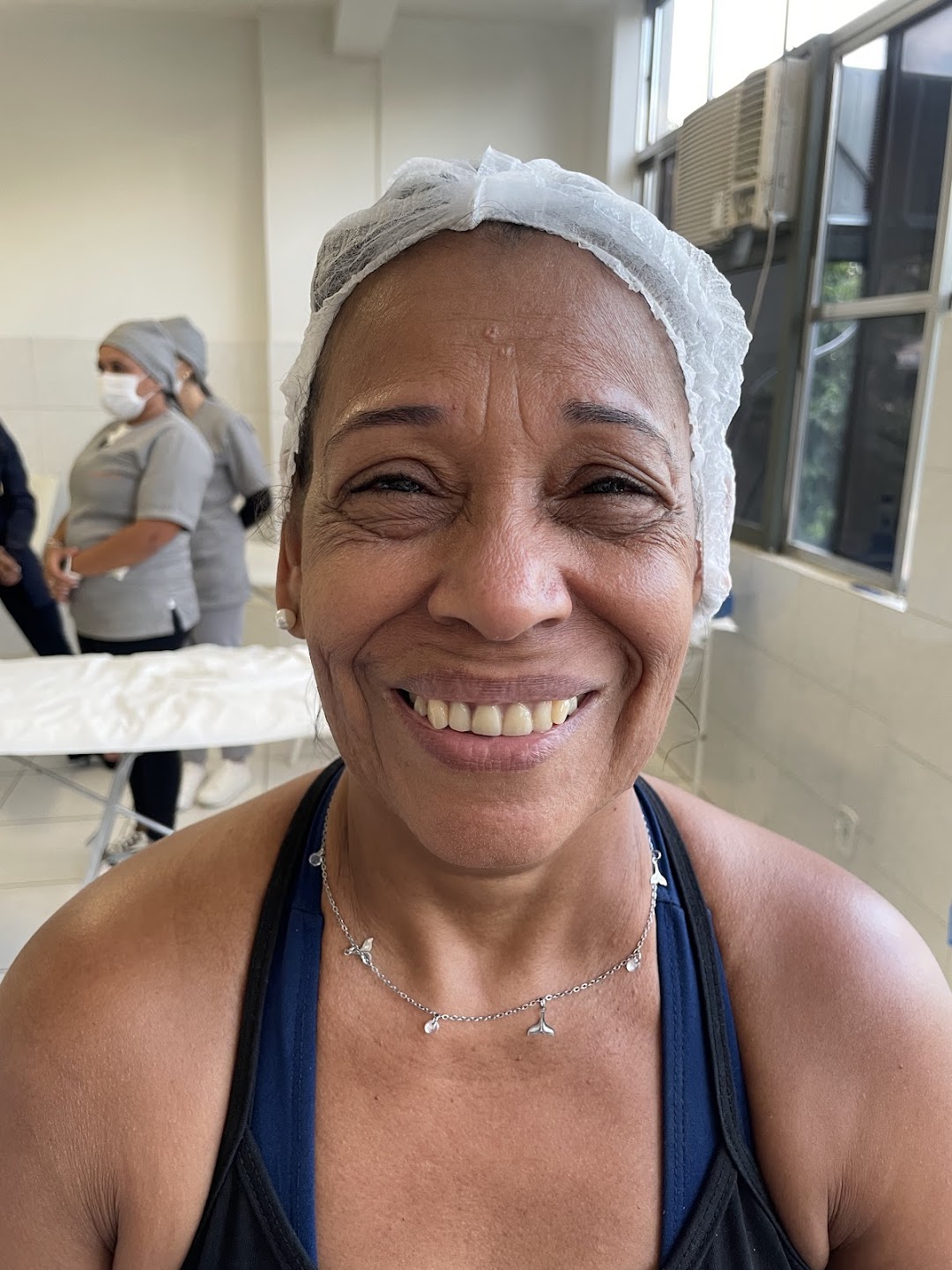 Bioestimulador de colágeno — antes e depois, Dra. Taiane Rodrigues