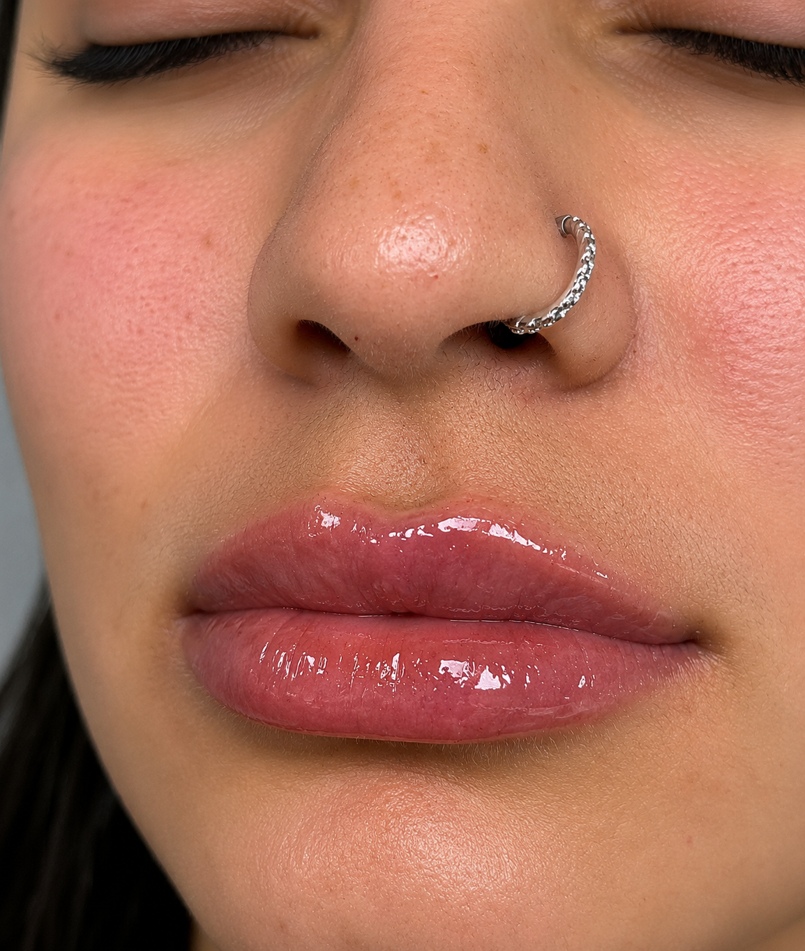 Resultado natural — Detalhe do resultado